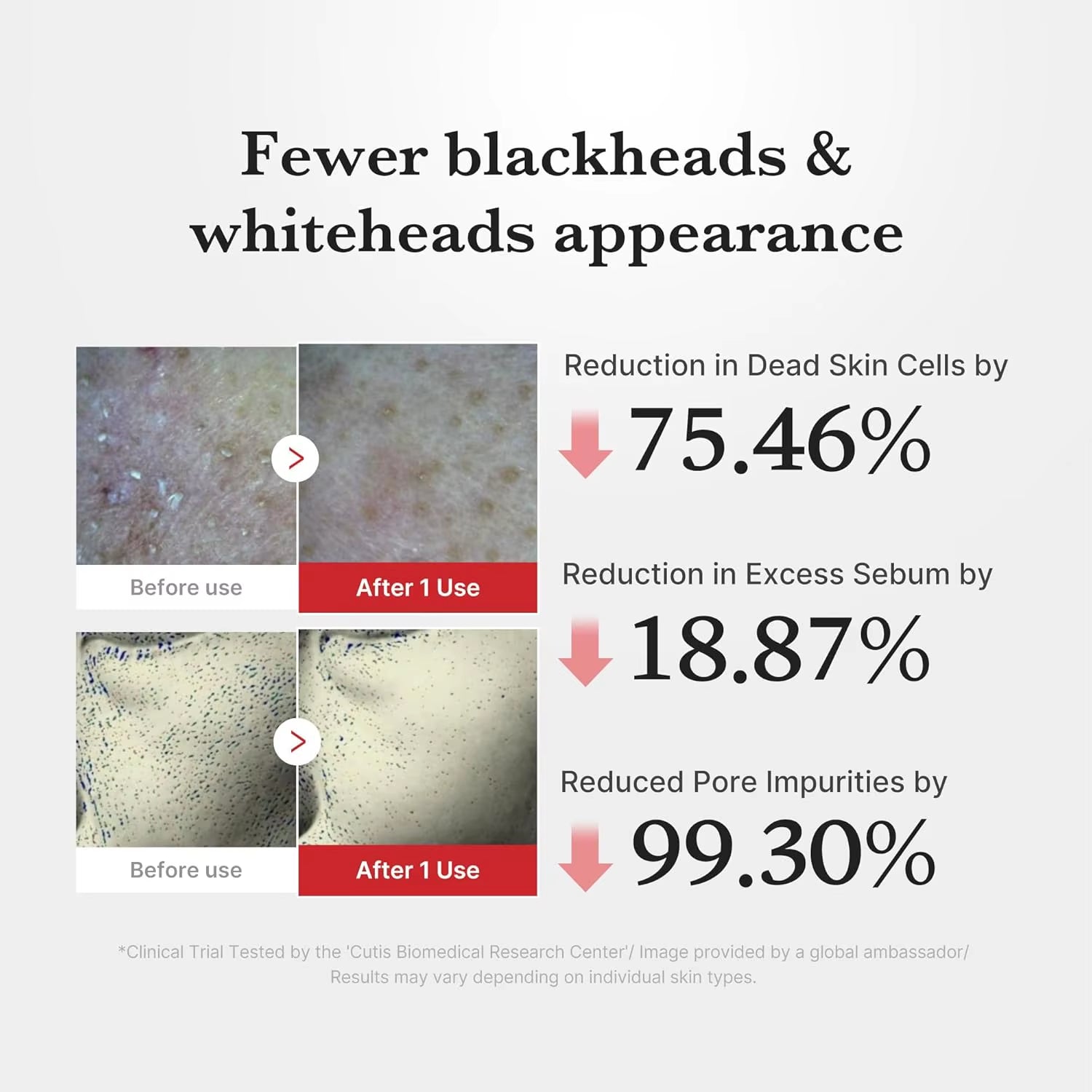 Medicube Peel Shot with Acid Gentle Exfoliating Serum for Dead Skin Cells Pores Blackheads Control for Exfoliating Serum