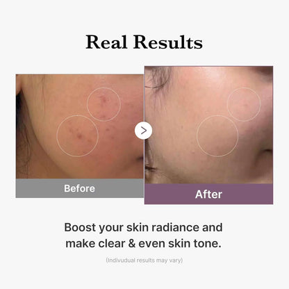 Illuminate Your Skin with Medicube Age-R Glutathione Glow Milky Toner – Experience Low-Irritation Radiance for an Even Skin Tone!