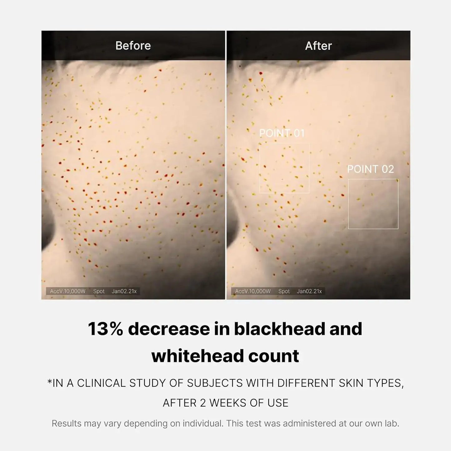 Revitalize Your Skin Overnight with Medicube Zero Pore One-Day Serum - Achieve Reduced Pore Appearance in Just 24 Hours!