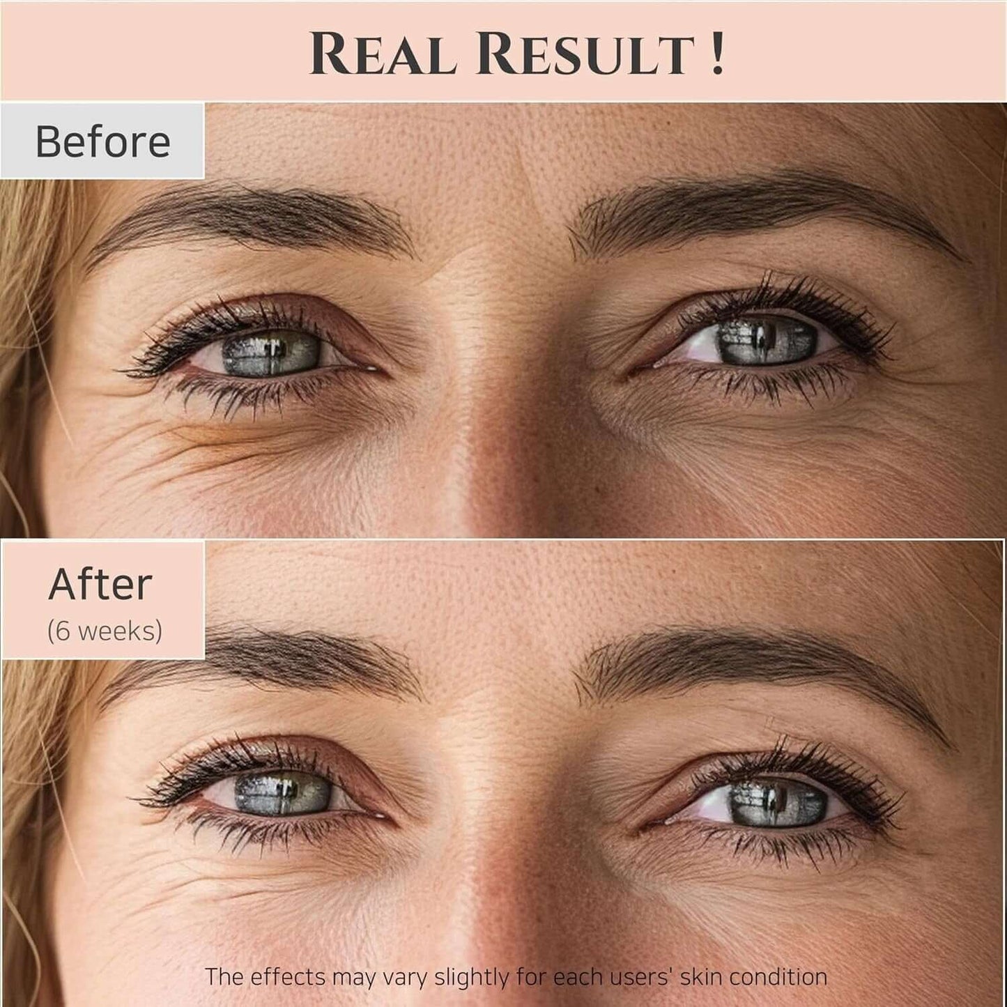 Revitalize Your Eyes with Beauty of Joseon Revive Eye Serum - Age-Defying Formula with Retinal and Niacinamide